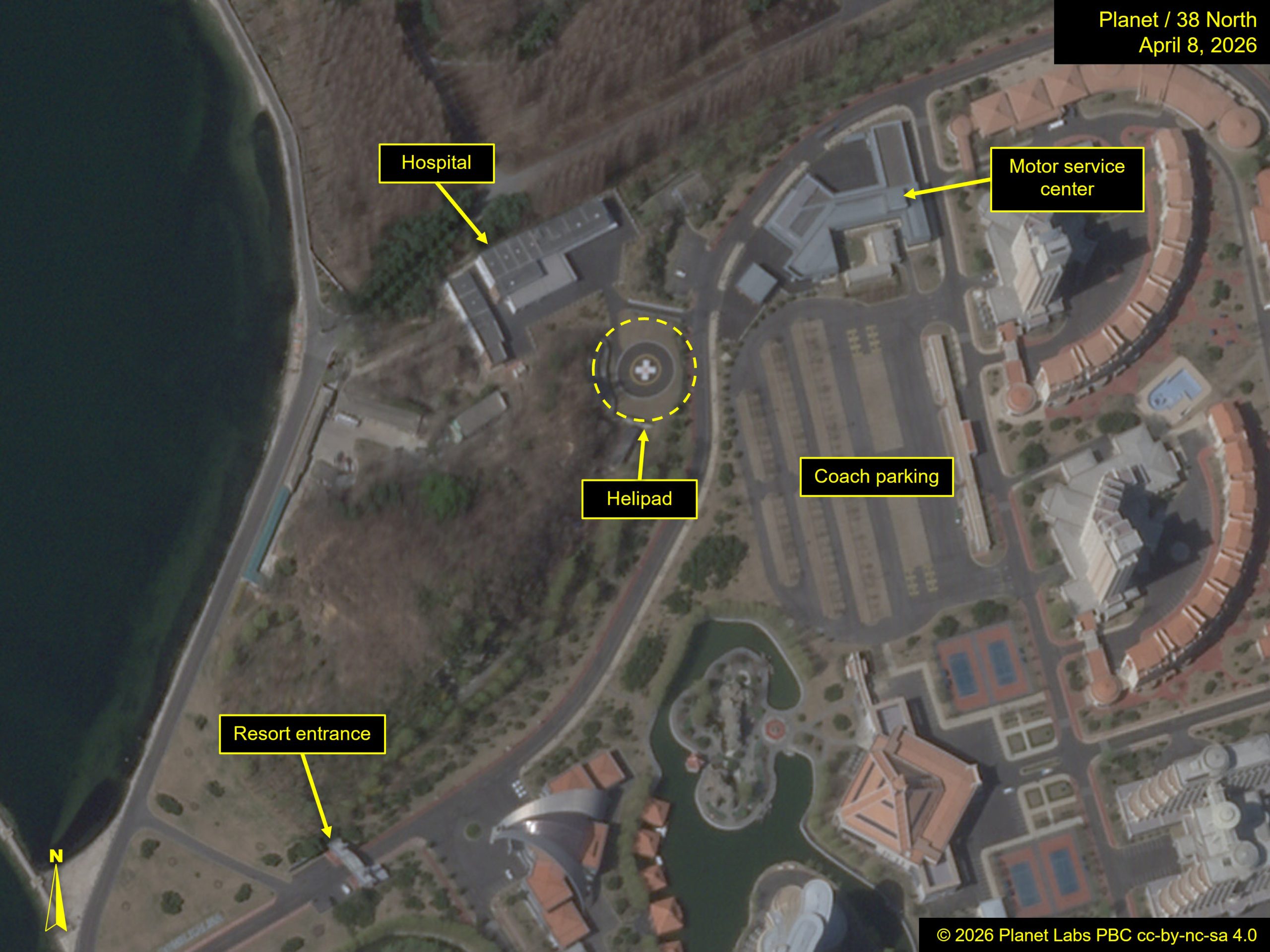 A Probable New Hospital at Wonsan-Kalma Beach Resort  